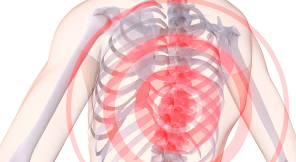 selkärangan kipu ja rintakehän osteokondroosi